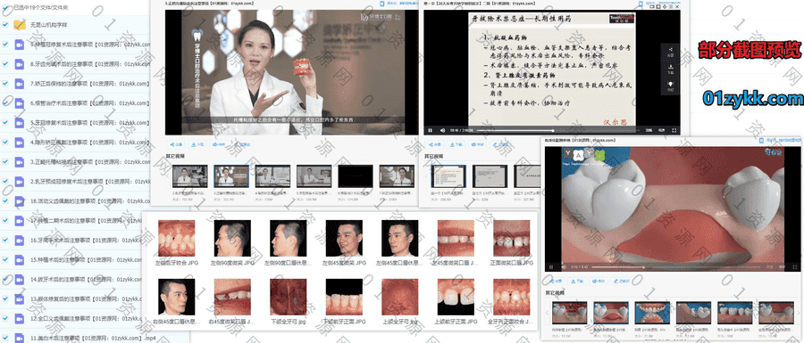 734G牙医培训牙齿正畸矫正视频课程+电子版素材百度网盘资源合集，包含美牙/拔牙/种植嵌体贴面/根管治疗/树脂美学修复/热牙胶充填……等_赚钱插图2