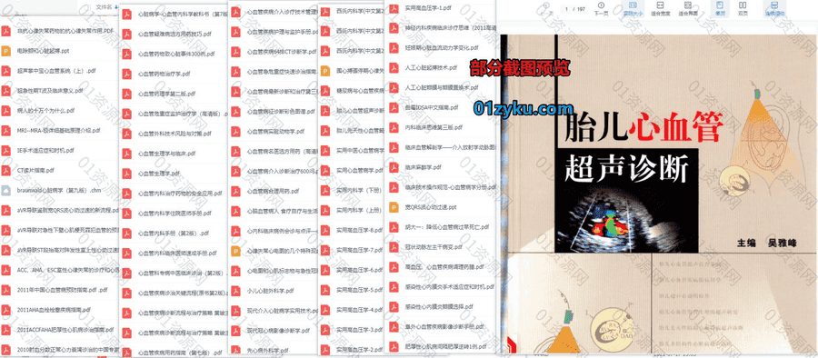 100本经典心血管类电子书PDF资源百度网盘合集，包含心脏外科手术技巧/实用中国心血管病学/现代冠心病影像诊断……等书籍_赚钱插图1